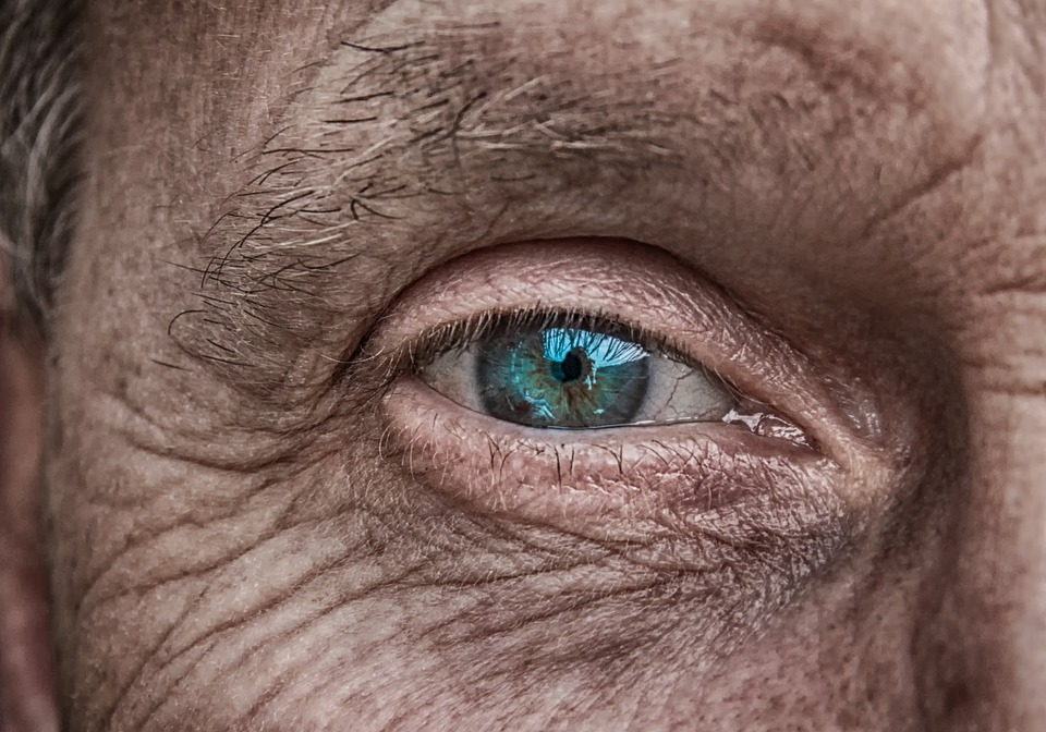 wrikled eyelid